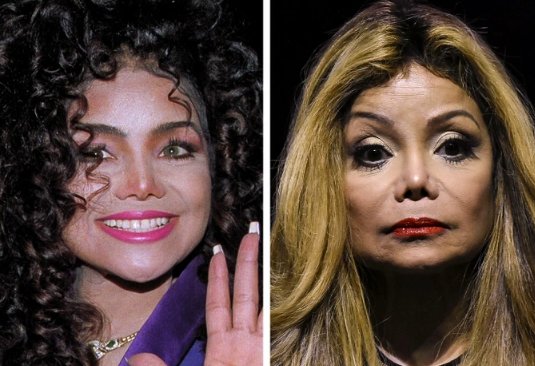 The Appearance Of Female Stars After Aging Is So Shocking